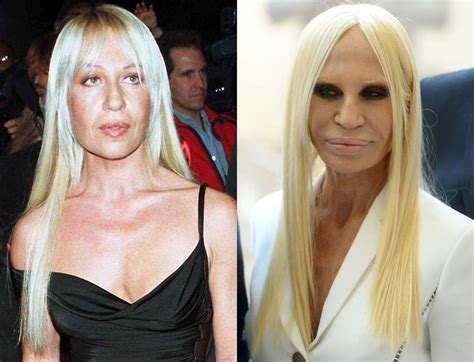 donatella versace foto 2015|donatella versace before and after.